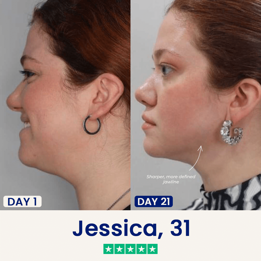 V-Sculpt | Jawline ve Gıdı Toparlayıcı Yüz Bandı