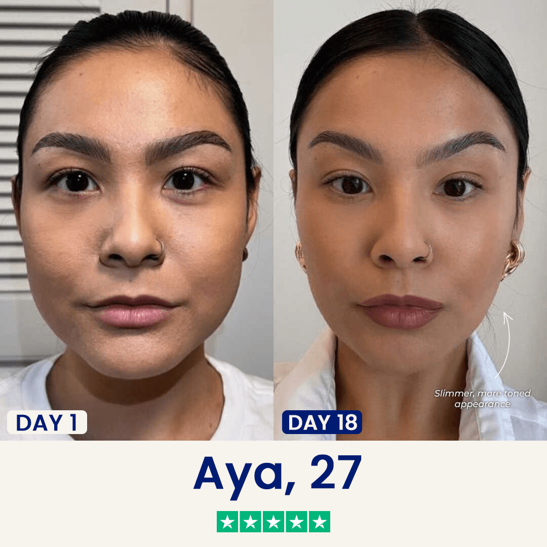 V-Sculpt | Jawline ve Gıdı Toparlayıcı Yüz Bandı