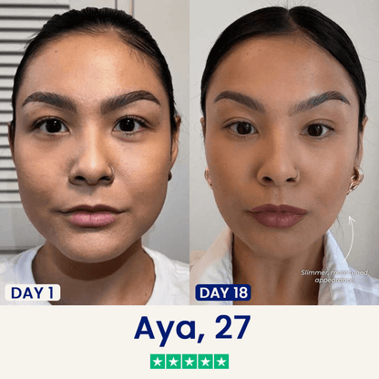 V-Sculpt | Jawline ve Gıdı Toparlayıcı Yüz Bandı